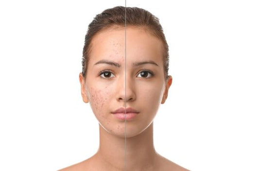 My Scar Spoke Louder Than My Smile—Until Mederma Helped Me Rewrite the Story