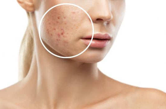 What If Your Scar Could Speak? A Letter to My Skin