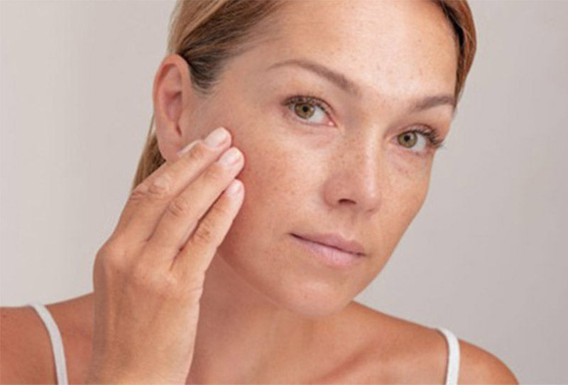 Dark Spots and Pigmentation: How to Identify, Treat, and Prevent Them
