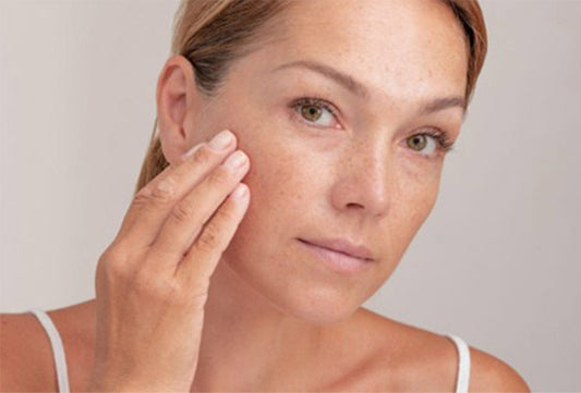 Dark Spots and Pigmentation: How to Identify, Treat, and Prevent Them
