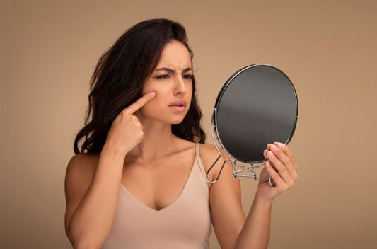 Does Stress Cause Pimples? Understanding Stress Acne & How to Manage It