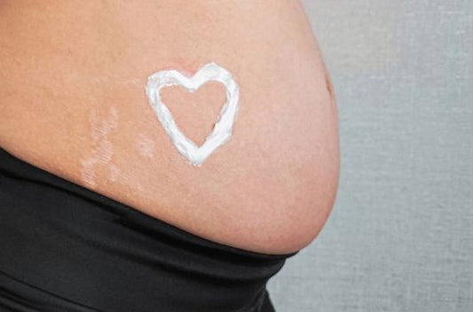 How Do Celebrities Avoid Stretch Marks During Pregnancy?