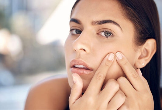 How to Remove Popped Pimple Scars: Simple Remedies for Clear Skin