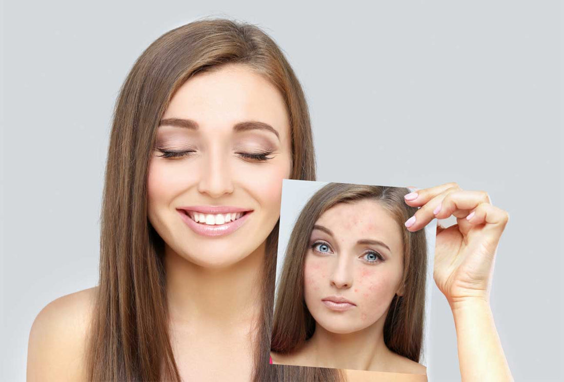 10 Proven Skin Glowing Tips for a Radiant Complexion