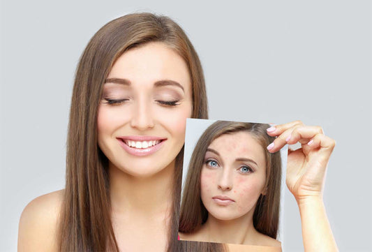 10 Proven Skin Glowing Tips for a Radiant Complexion