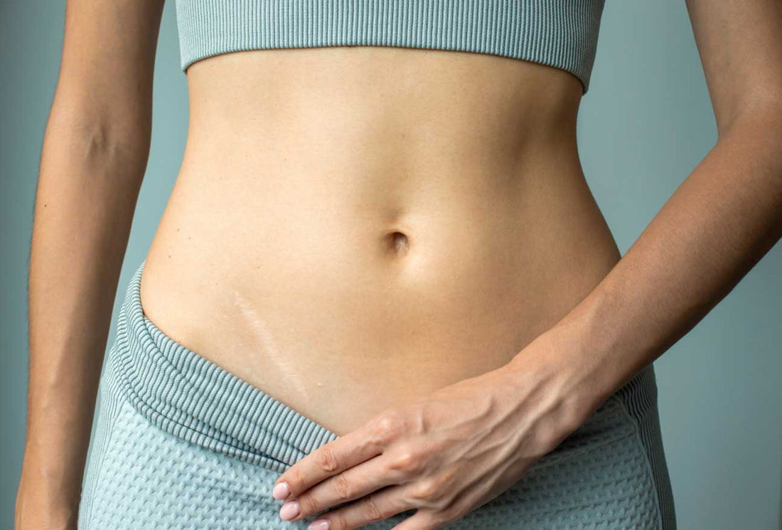 Surgery Scar Removal Creams: Effective Solutions for Smoother Skin
