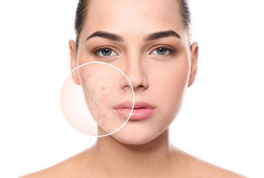 Discover the Best Scar Removal Cream: Top Picks for Smooth, Clear Skin