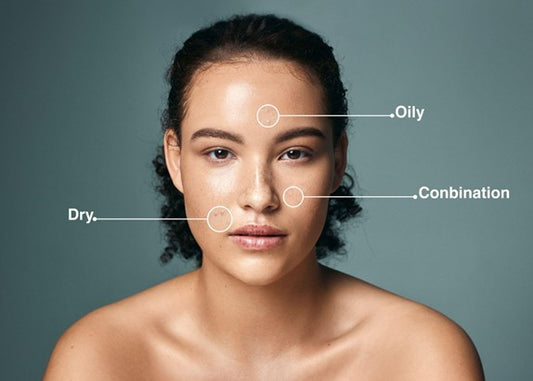 Easy Way to Know Your Skin Type for Perfect Skincare