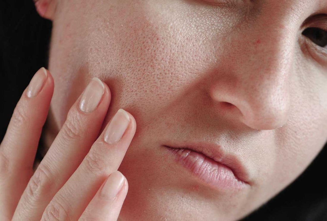 The Truth About Your Skin: Discovering the Types of Pores on Your Face