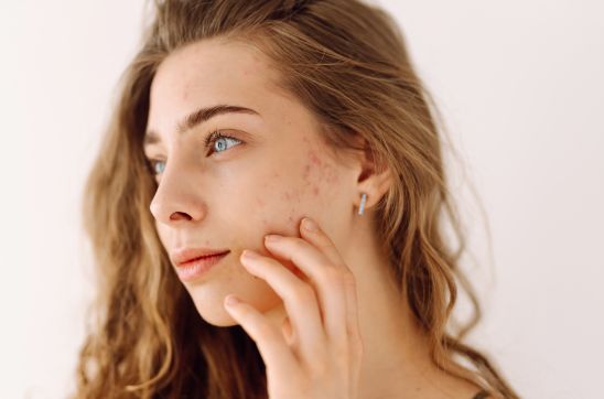 Types of Scars on Face: Causes, Identification & Treatments