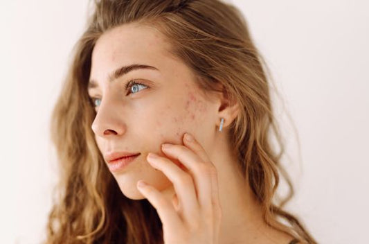 Types of Scars on Face: Causes, Identification & Treatments