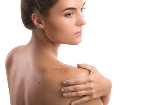 Seasonal Scar Care: Prep Your Skin for Every Season