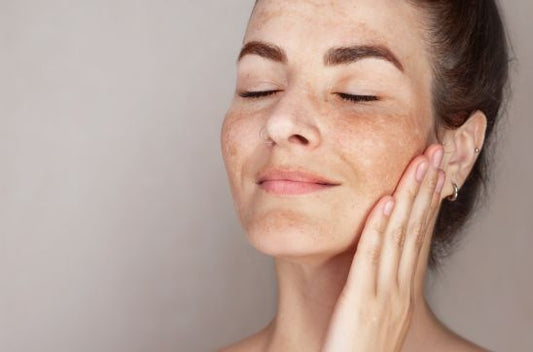 Understanding Different Types of Pigmentation and How to Treat Them