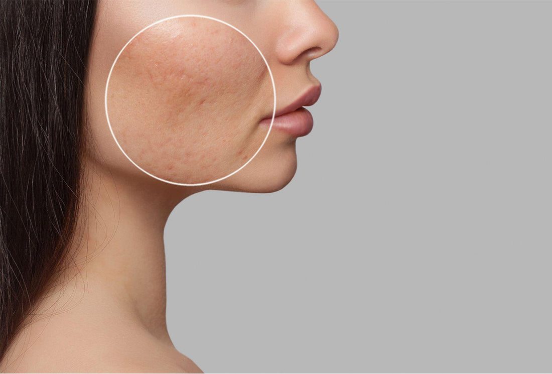 Simple Steps for Daily Skincare Routine for Glowing Skin