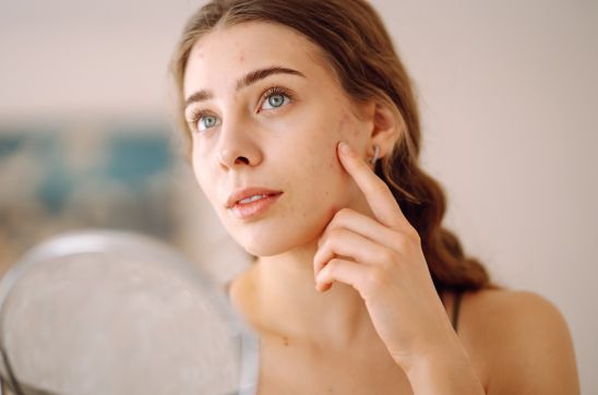 30 0 Day Countdown: Mederma Scar Prep Plan