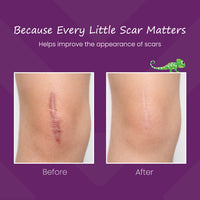 Mederma Scar Gel for Kids