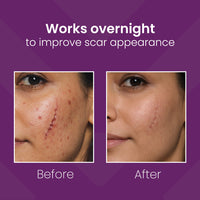 Mederma PM Intensive Overnight Scar Cream