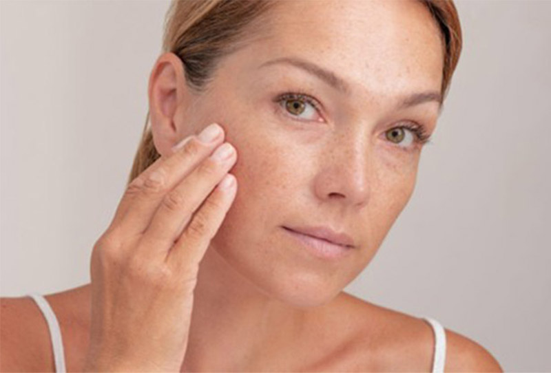 Dark Spots and Pigmentation: How to Identify, Treat, and Prevent Them