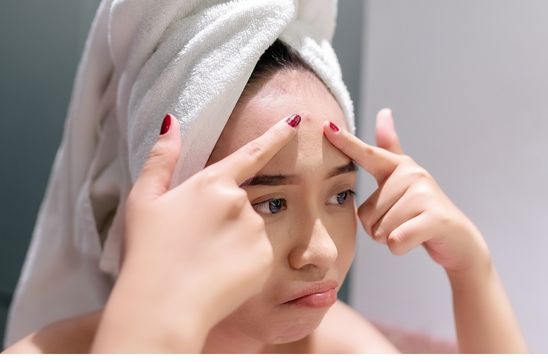 Forehead Pimple Reason: Common Causes & How to Prevent Breakouts