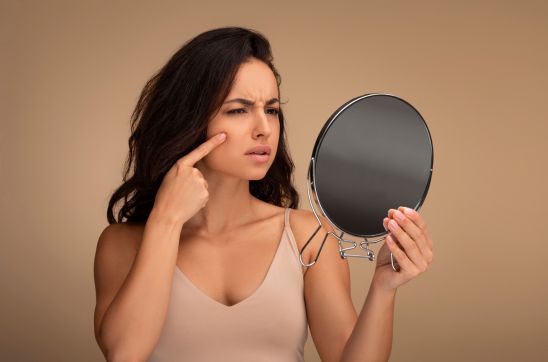 Does Stress Cause Pimples? Understanding Stress Acne & How to Manage It