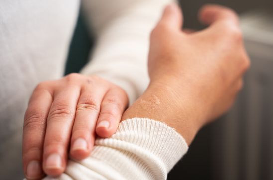 How to Remove Accident Scars: Complete Guide to Faster Healing