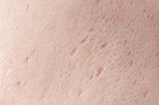 What are Rolling Scars? Causes, Types, and How They Form